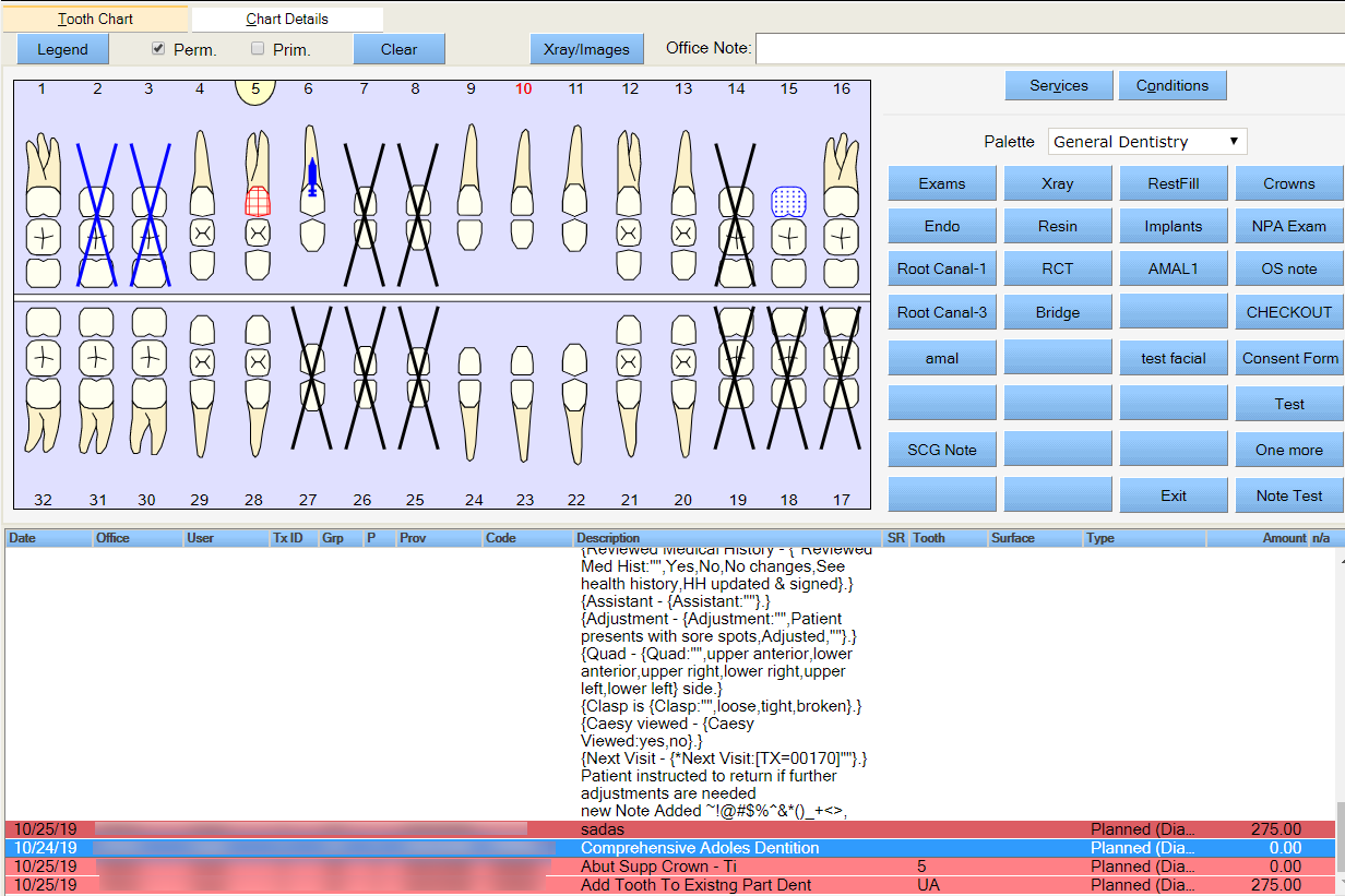 chart grid